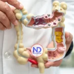 Crohn y colitis ulcerosa son enfermedades crónicas que inflaman el intestino
