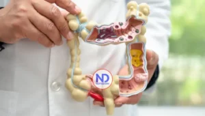 Crohn y colitis ulcerosa son enfermedades crónicas que inflaman el intestino