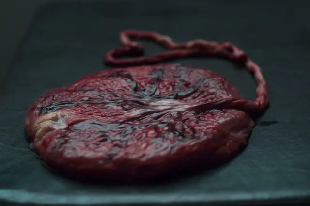 eficacia antienvejecimiento de la placenta human Así operaba la red acusada de traficar con placentas humanas