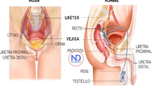 ¿Cómo afecta la calidad de vida en el paciente con estrechez uretral?