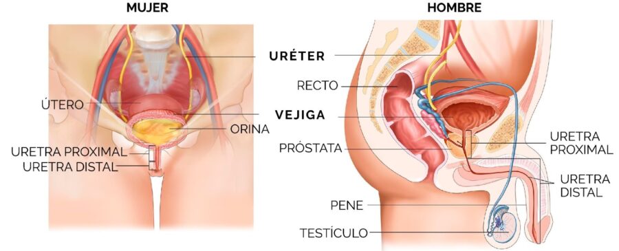 ¿Cómo afecta la calidad de vida en el paciente con estrechez uretral? 3 estrechez uretral ¿Cómo afecta la calidad de vida en el paciente con estrechez uretral?