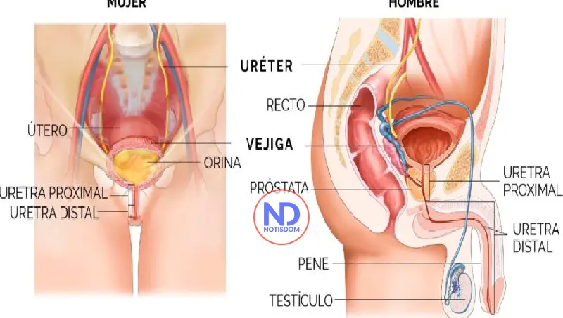 ¿Cómo afecta la calidad de vida en el paciente con estrechez uretral?
