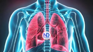 Hipertensión arterial pulmonar: síntomas y diagnóstico tardío preocupan en América Latina