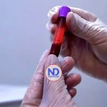 Sangre capilar, nueva herramienta antidopaje